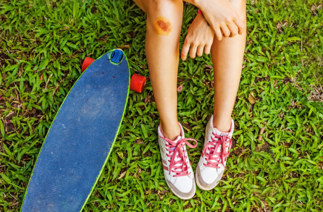 Bol to skateboard či paddleboard? Na tom už nezáleží. Na vašom poistení však áno